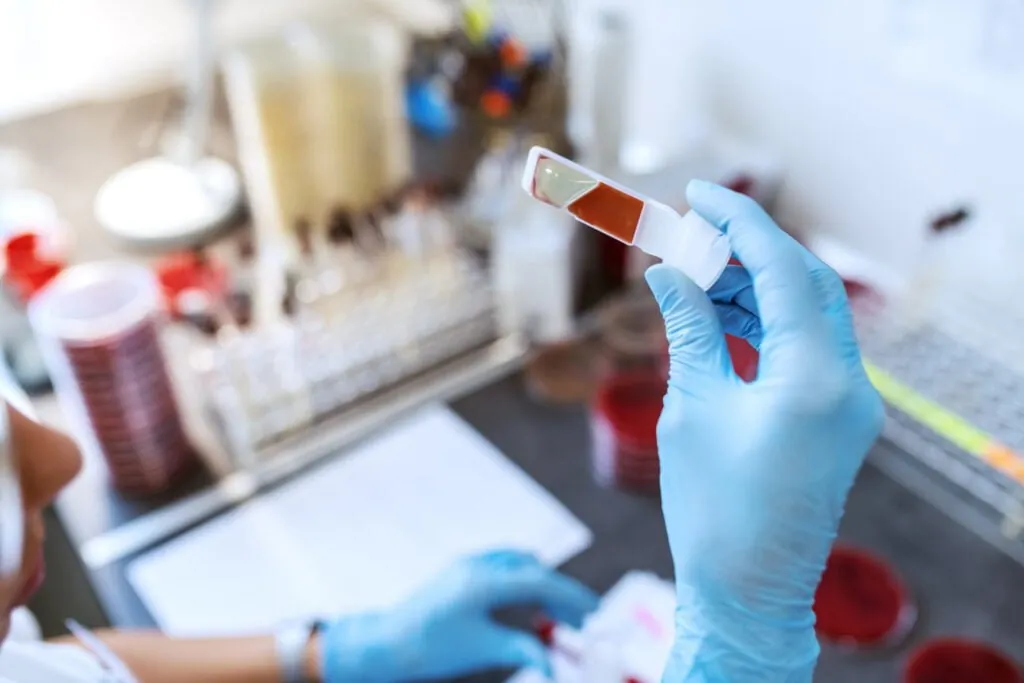 Exames de sangue periódicos são importantes para o acompanhamento e diagnóstico da diabetes