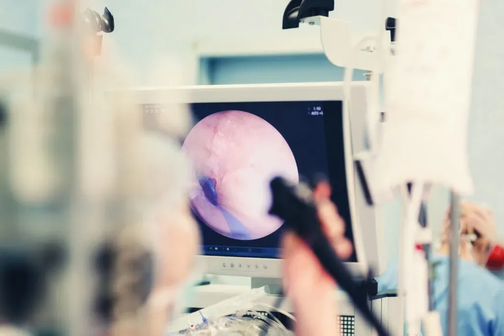 Endoscopia com biópsia: o que preciso saber antes de realizar o exame?